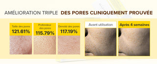 Amélioration des pores cliniquement prouvée - comparaison peau avant utilisation et après 4 semaines