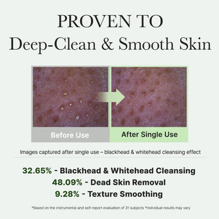 Arencia Fresh Green Rice Mochi Cleanser - avant et apres nettoyage pores, resultats cliniques