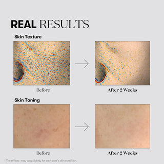 Resultats avant-apres VT Cosmetics 1000 Shot sur texture et teint de la peau apres deux semaines
