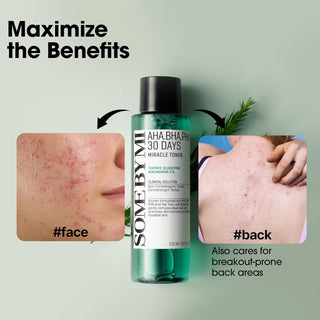 AHA BHA PHA 30 Days Miracle Toner - 150ml