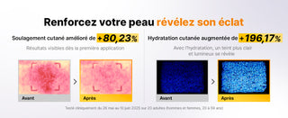COSRX Snail 96 Mucin Essence - comparatif avant-apres soulagement cutane et hydratation +196%