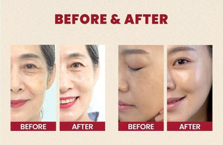 Resultats avant et apres utilisation du serum KSECRET Seoul 1988 Retinal sur deux visages feminins