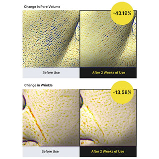 Resultats cliniques Celimax Retinol Shot - pores -43% et rides -13% apres deux semaines (version EN)