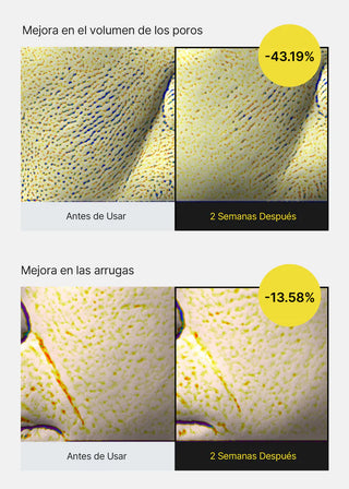 Resultats cliniques Celimax Retinol Shot - pores -43% et rides -13% apres deux semaines (version ES)