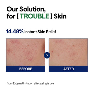 Resultat avant-apres peau irritee avec le serum MEDIHEAL Teatree montrant une reduction visible des rougeurs