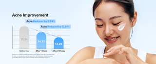 Graphique reduction de l'acne avec Beauty of Joseon Relief Sun Rice + B5 et femme souriante