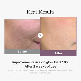 Resultat avant-apres MEDICUBE Glutathione Glow Capsule Cream - eclat ameliore de 37,8% en 2 semaines