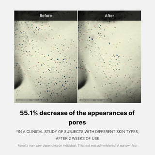 Etude clinique avant-apres Medicube Zero Pore One Day Cream montrant 55% de reduction de l'apparence des pores