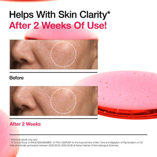 Resultat avant et apres 2 semaines sur la clarte de la peau avec le serum ANUA Niacinamide 10+ TXA 4