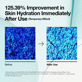 ANUA PDRN Glow Pad - resultat etude clinique hydratation +125% avec photos microscopiques avant et apres