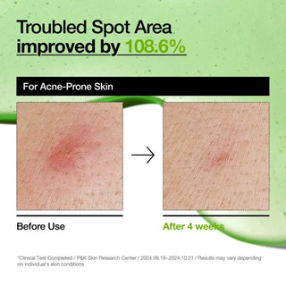 Avant/après 4 semaines sur peau à imperfections, zone rouge atténuée : test clinique ANUA