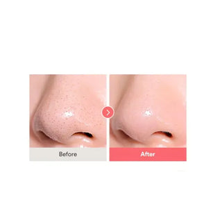 Calamine Pore Control Cleansing Oil - 200ml