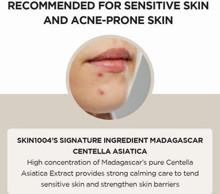 Visuel peaux sensibles et sujettes à l'acné - gros plan menton avec imperfections, centella apaisante SKIN1004